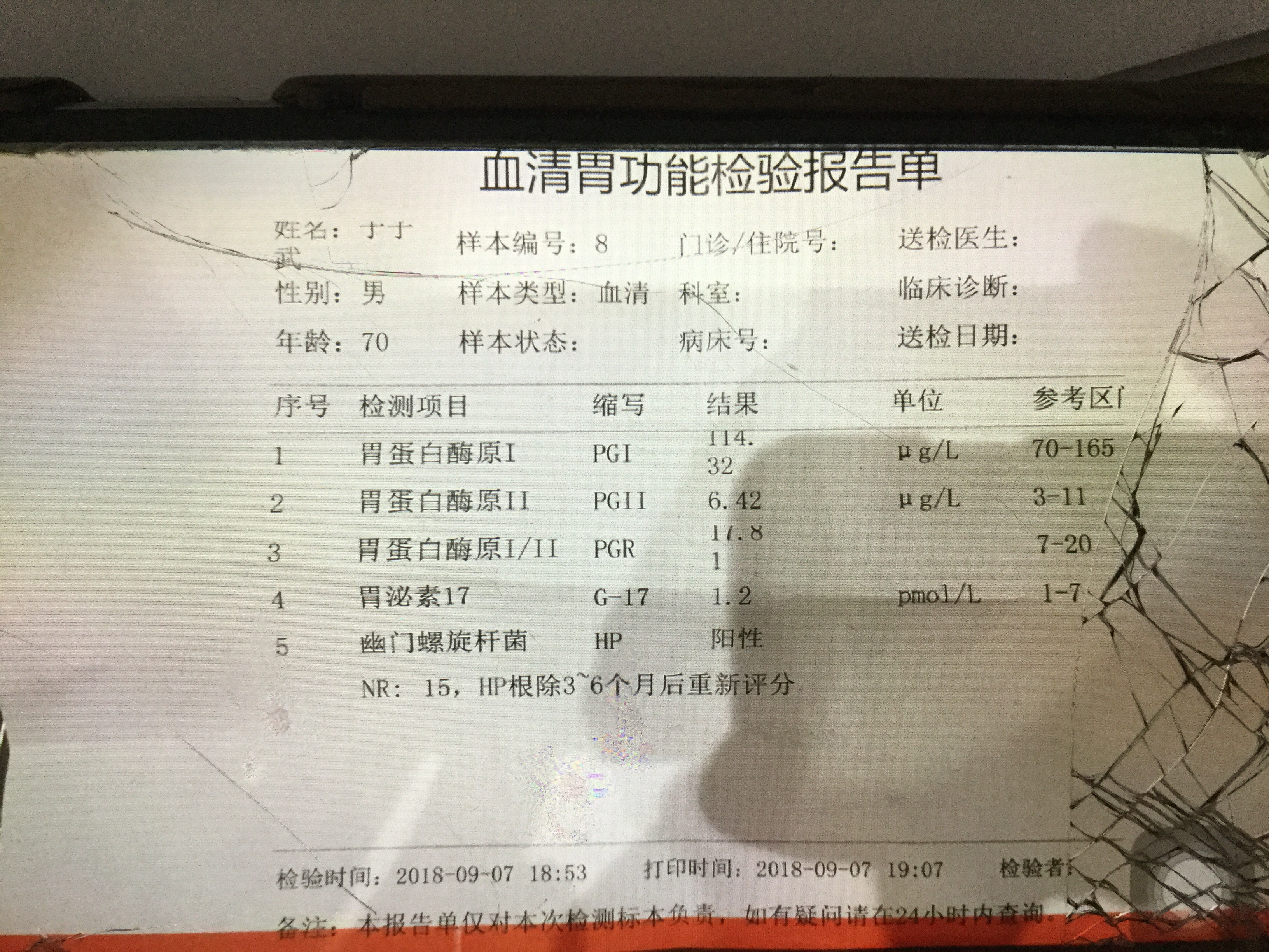 labimage/40/153828071104640671.jpg